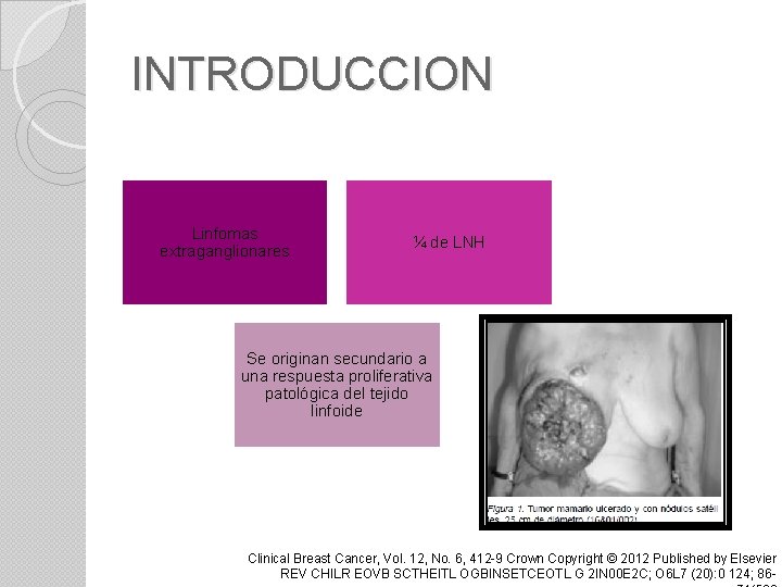 INTRODUCCION Linfomas extraganglionares ¼ de LNH Se originan secundario a una respuesta proliferativa patológica