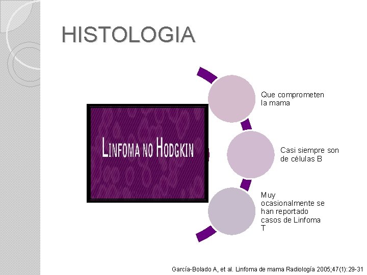 HISTOLOGIA Que comprometen la mama Los linfomas no Hodgkin Casi siempre son de células