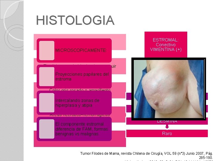 HISTOLOGIA MACROSCÓPICAMENTE: MICROSCOPICAMENTE: ESTROMAL: Conectivo VIMENTINA (+) El tejido comprimido tiende a protruir Proyecciones