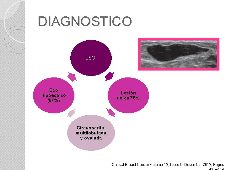 DIAGNOSTICO USG: Eco hipoecoico (87%) Lesión única 75% Circunscrita, multilobulada y ovalada Clinical Breast