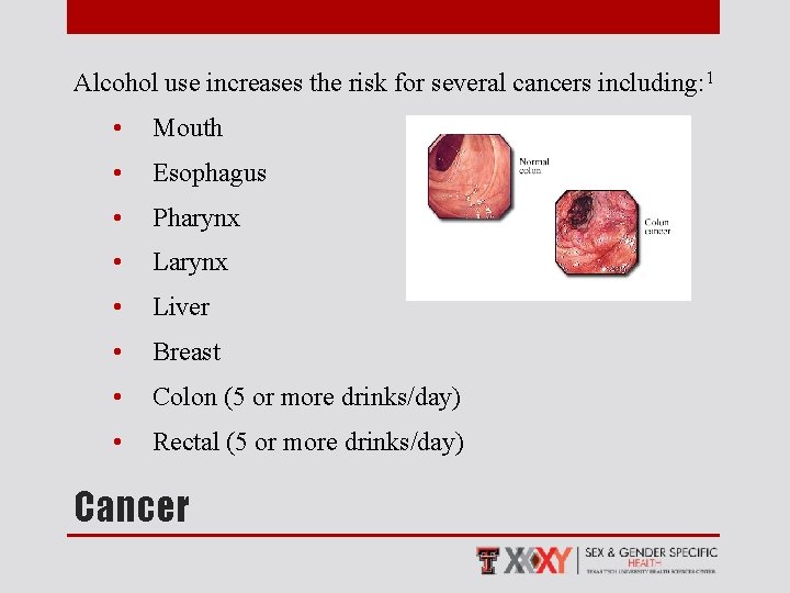 Alcohol use increases the risk for several cancers including: 1 • Mouth • Esophagus