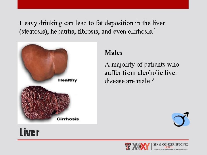 Heavy drinking can lead to fat deposition in the liver (steatosis), hepatitis, fibrosis, and