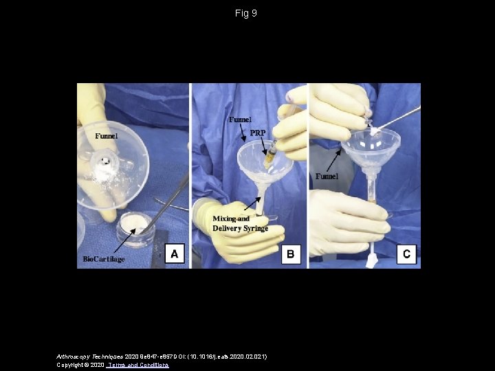 Fig 9 Arthroscopy Techniques 2020 9 e 847 -e 857 DOI: (10. 1016/j. eats.