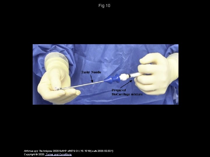 Fig 10 Arthroscopy Techniques 2020 9 e 847 -e 857 DOI: (10. 1016/j. eats.