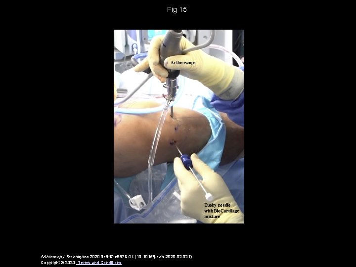 Fig 15 Arthroscopy Techniques 2020 9 e 847 -e 857 DOI: (10. 1016/j. eats.