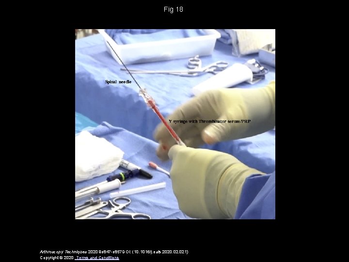 Fig 18 Arthroscopy Techniques 2020 9 e 847 -e 857 DOI: (10. 1016/j. eats.