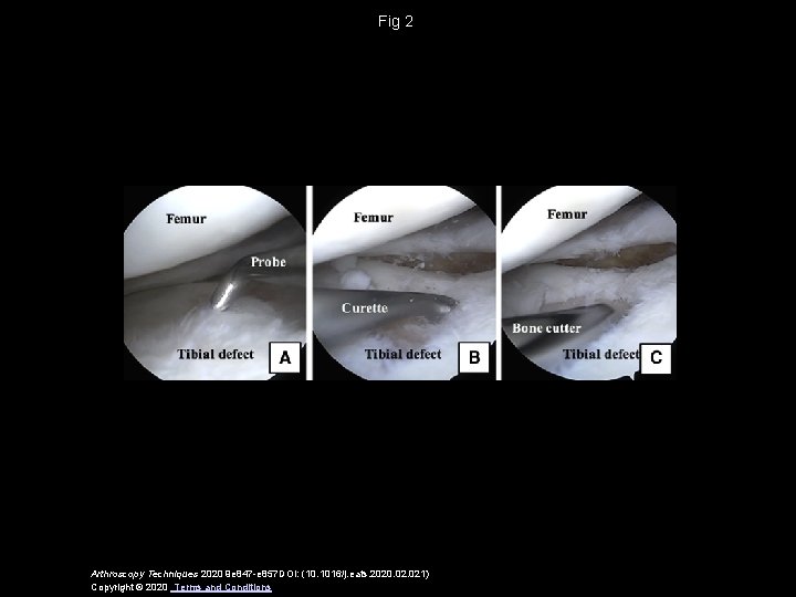 Fig 2 Arthroscopy Techniques 2020 9 e 847 -e 857 DOI: (10. 1016/j. eats.