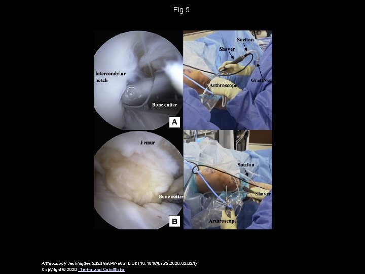 Fig 5 Arthroscopy Techniques 2020 9 e 847 -e 857 DOI: (10. 1016/j. eats.