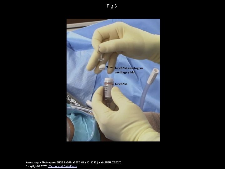 Fig 6 Arthroscopy Techniques 2020 9 e 847 -e 857 DOI: (10. 1016/j. eats.