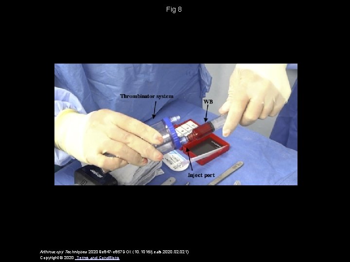 Fig 8 Arthroscopy Techniques 2020 9 e 847 -e 857 DOI: (10. 1016/j. eats.