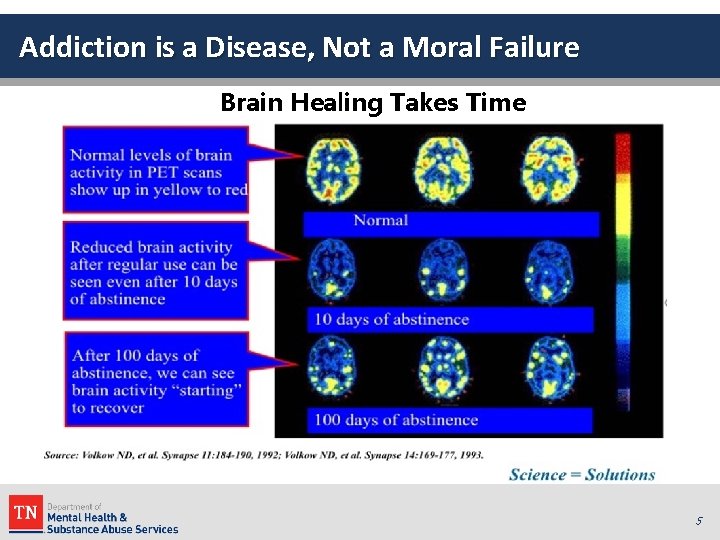 Addiction is a Disease, Not a Moral Failure Brain Healing Takes Time 5 