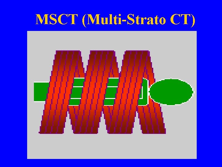 MSCT (Multi-Strato CT) 