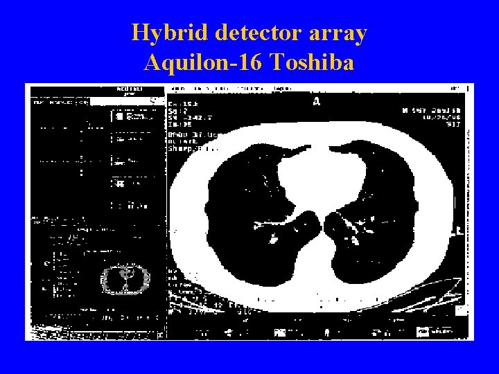 Hybrid detector array Aquilon-16 Toshiba 