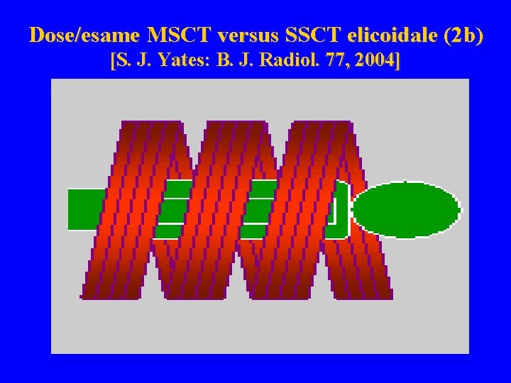 Dose/esame MSCT versus SSCT elicoidale (2 b) [S. J. Yates: B. J. Radiol. 77,