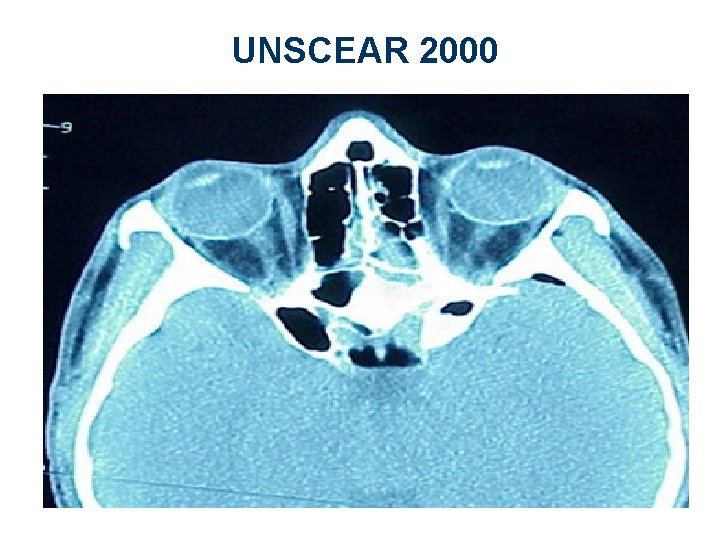 UNSCEAR 2000 