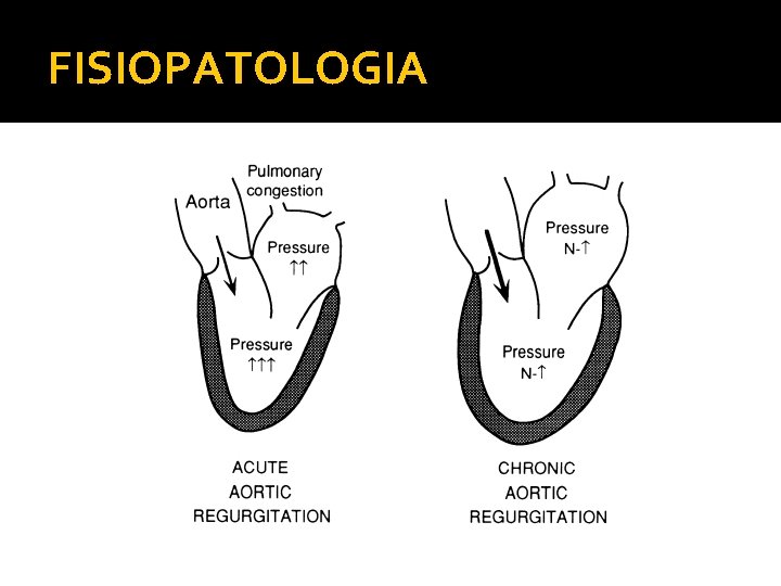 FISIOPATOLOGIA 