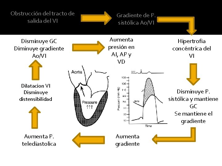 Obstrucción del tracto de salida del VI Disminuye GC Diminuye gradiente Ao/VI Gradiente de