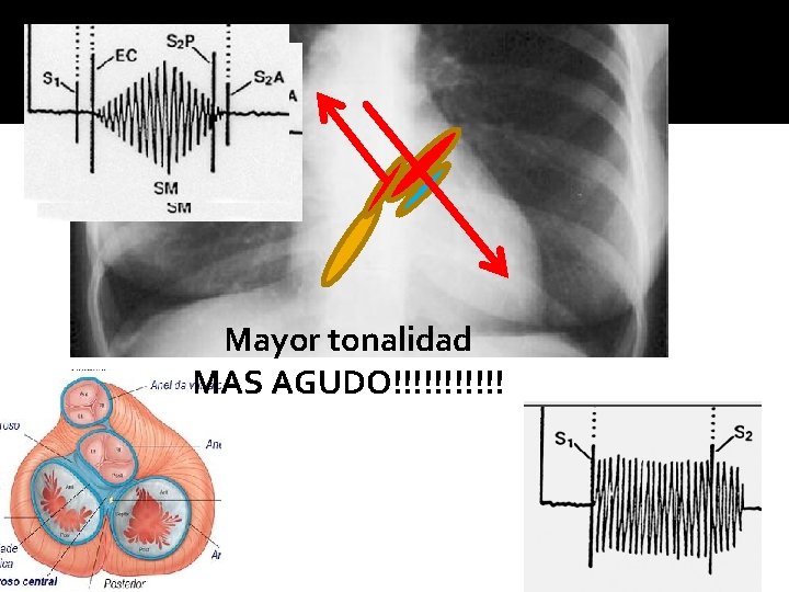 Mayor tonalidad MAS AGUDO!!!!!! 