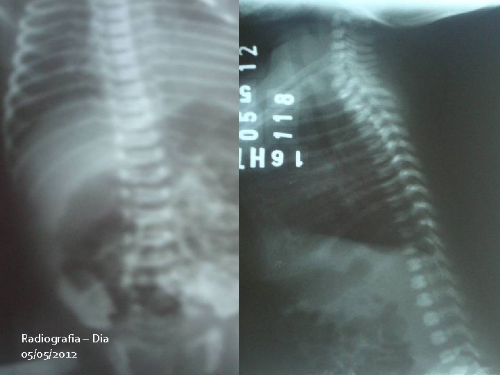 Radiografia – Dia 05/05/2012 11/10/2020 