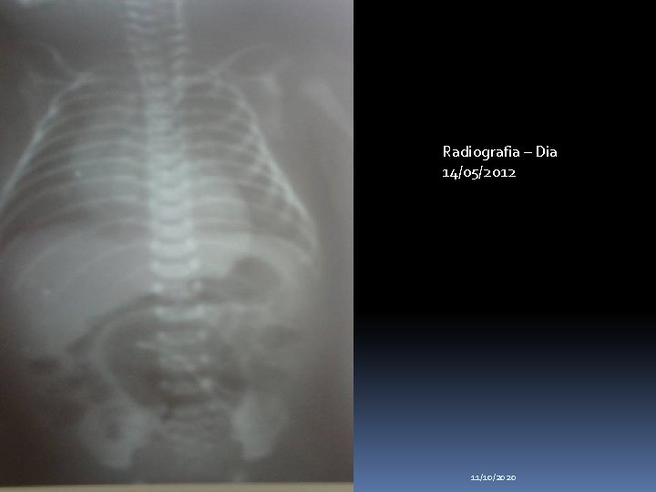 Radiografia – Dia 14/05/2012 11/10/2020 