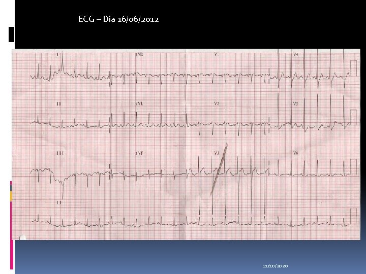 ECG – Dia 16/06/2012 11/10/2020 