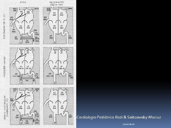 Cardiologia Pediátrica Radi & Snitcowsky Macruz 11/10/2020 