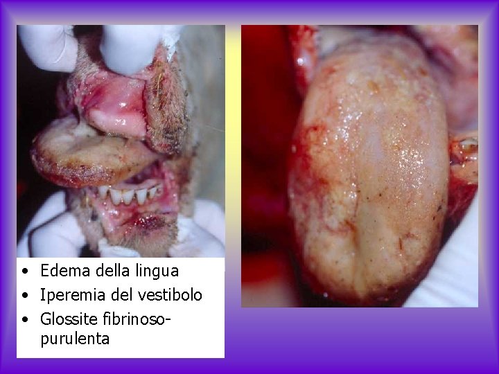  • Edema della lingua • Iperemia del vestibolo • Glossite fibrinosopurulenta 