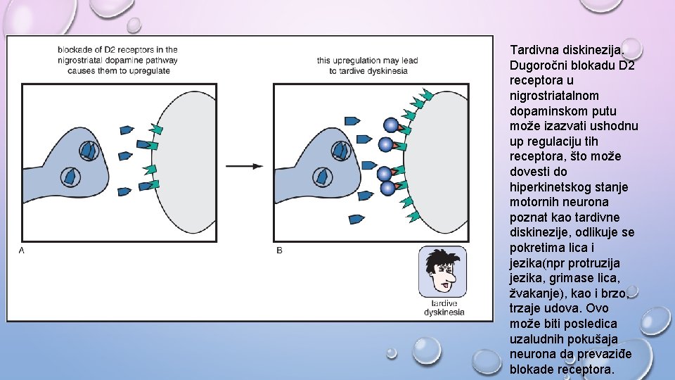 Tardivna diskinezija. Dugoročni blokadu D 2 receptora u nigrostriatalnom dopaminskom putu može izazvati ushodnu