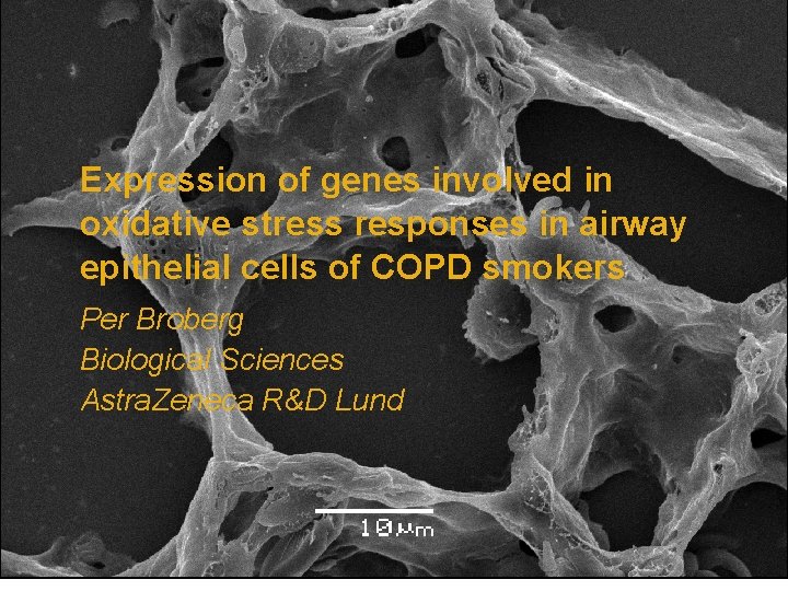 Expression of genes involved in oxidative stress responses in airway epithelial cells of COPD