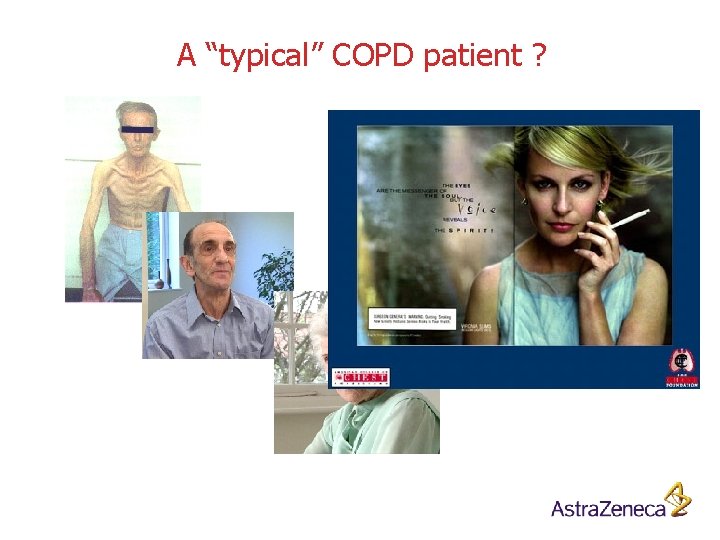 A “typical” COPD patient ? 
