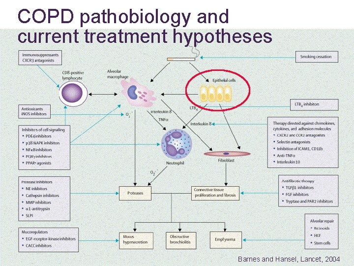 COPD pathobiology and current treatment hypotheses Barnes and Hansel, Lancet, 2004 