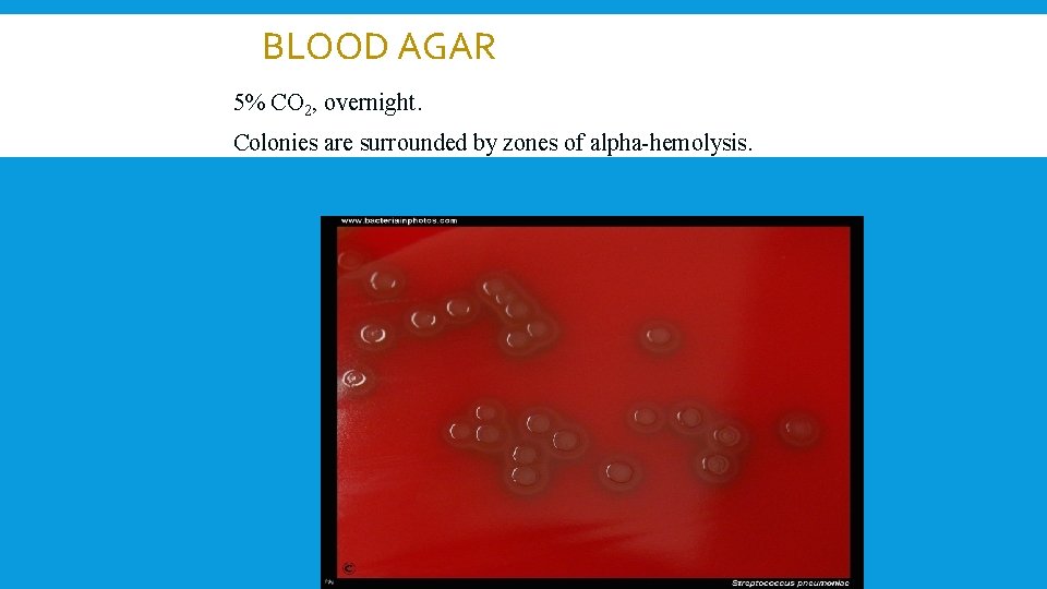 BLOOD AGAR 5% CO 2, overnight. Colonies are surrounded by zones of alpha-hemolysis. 
