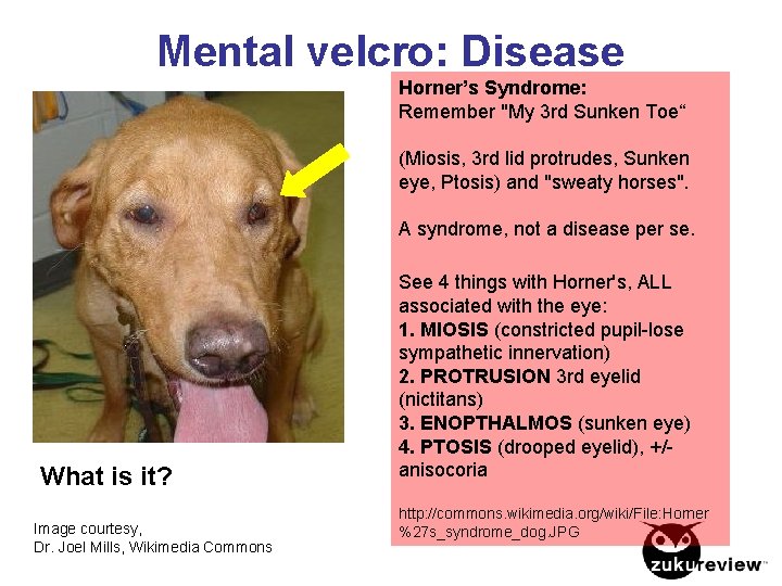 Mental velcro: Disease Horner’s Syndrome: Remember "My 3 rd Sunken Toe“ (Miosis, 3 rd