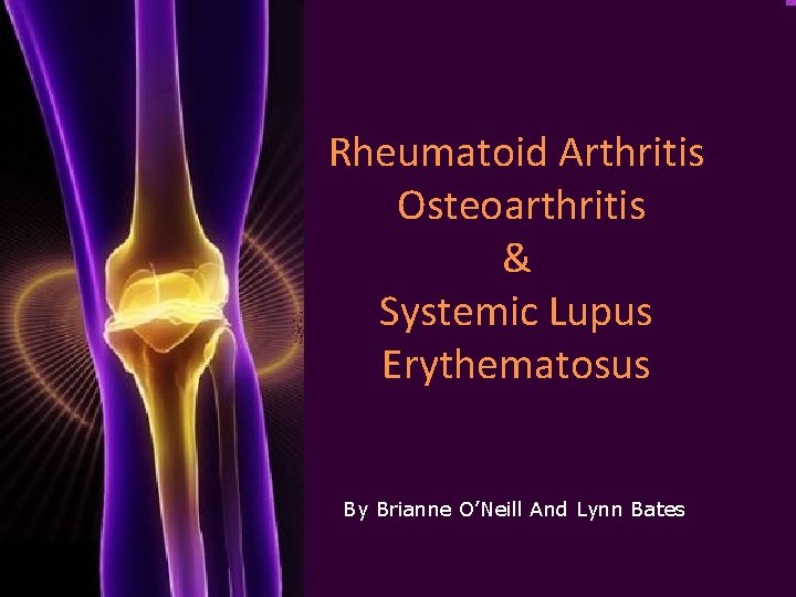 Rheumatoid Arthritis Osteoarthritis & Systemic Lupus Erythematosus By Brianne O’Neill And Lynn Bates 