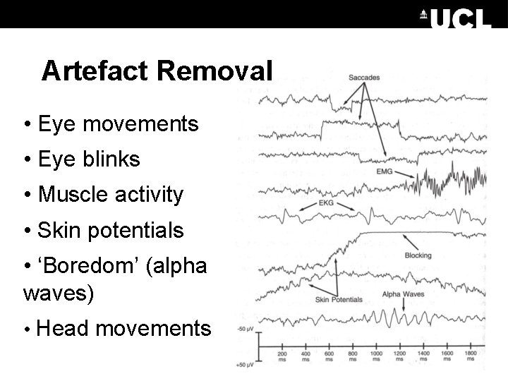 Artefact Removal • Eye movements • Eye blinks • Muscle activity • Skin potentials