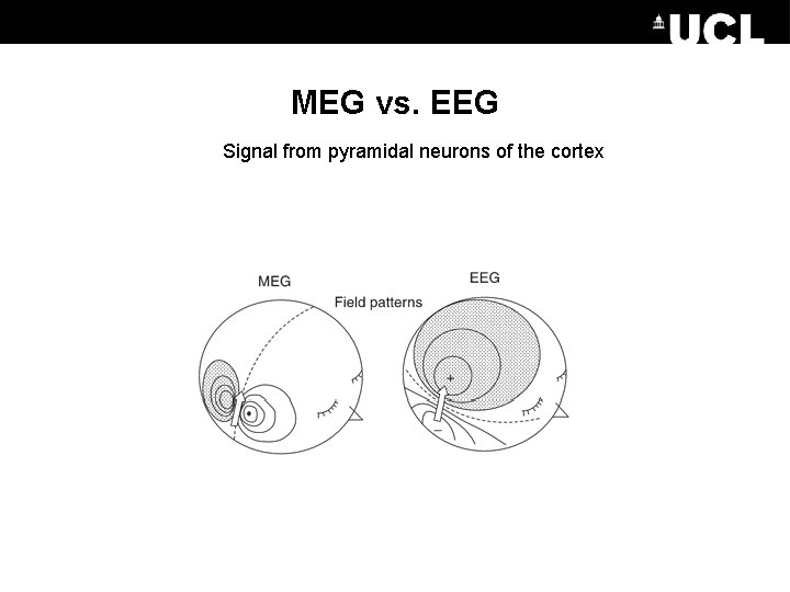 MEG vs. EEG Signal from pyramidal neurons of the cortex 