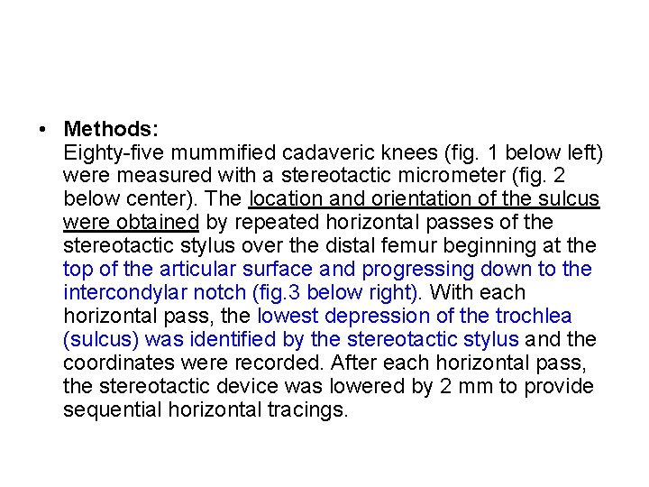  • Methods: Eighty five mummified cadaveric knees (fig. 1 below left) were measured