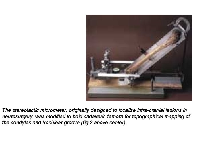 The stereotactic micrometer, originally designed to localize intra-cranial lesions in neurosurgery, was modified to