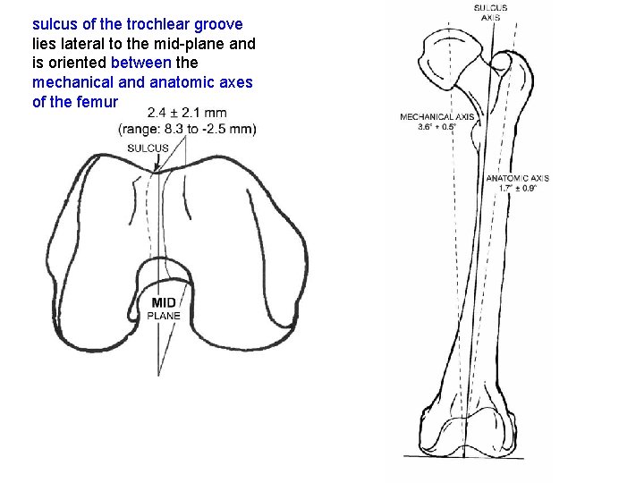 sulcus of the trochlear groove lies lateral to the mid plane and is oriented
