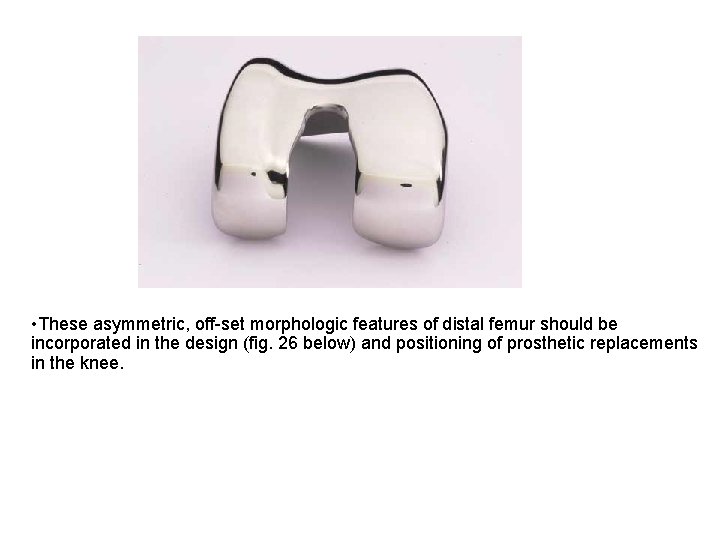  • These asymmetric, off set morphologic features of distal femur should be incorporated