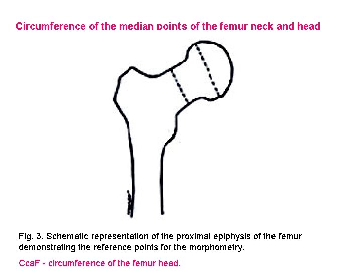 Circumference of the median points of the femur neck and head Fig. 3. Schematic