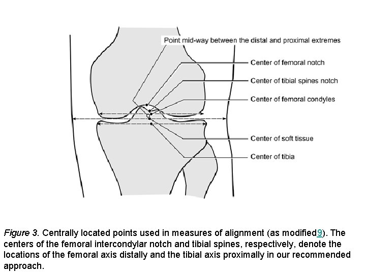 Figure 3. Centrally located points used in measures of alignment (as modified 9). The