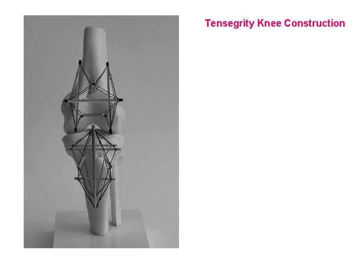 Tensegrity Knee Construction 