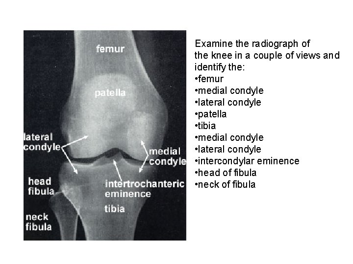 Examine the radiograph of the knee in a couple of views and identify the: