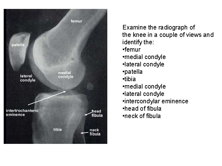 Examine the radiograph of the knee in a couple of views and identify the: