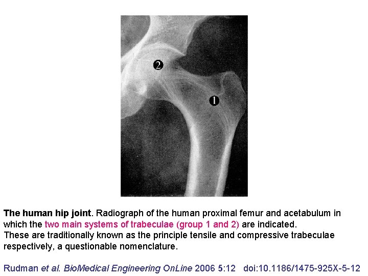 The human hip joint. Radiograph of the human proximal femur and acetabulum in which