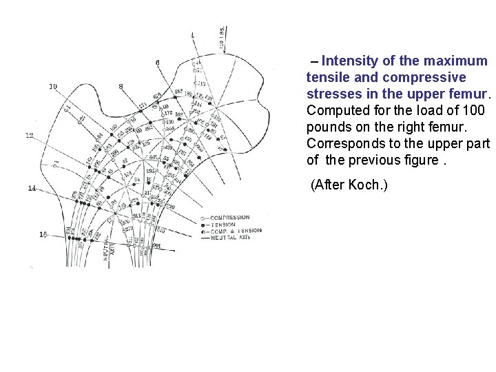  – Intensity of the maximum tensile and compressive stresses in the upper femur.