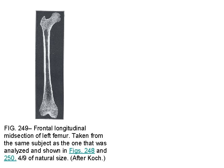 FIG. 249– Frontal longitudinal midsection of left femur. Taken from the same subject as