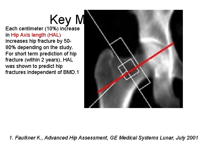 Key Measurements Each centimeter (10%) increase in Hip Axis length (HAL) increases hip fracture