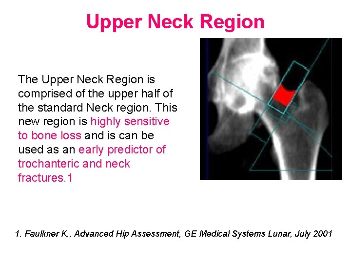 Upper Neck Region The Upper Neck Region is comprised of the upper half of